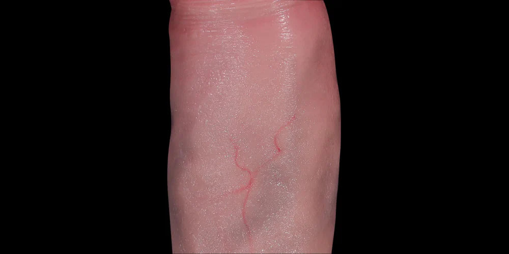 Defined Ridge